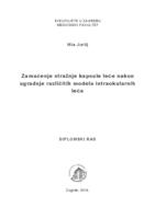 prikaz prve stranice dokumenta Zamućenje stražnje kapsule leće nakon ugradnje različitih modela intraokularnih leća