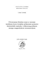 prikaz prve stranice dokumenta Privremene fetalne zone u razvoju moždane kore čovjeka prikazane pomoću histoloških metoda i slikovnog prikaza mozga magnetskom rezonancijom