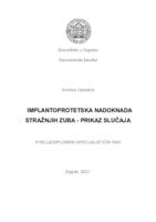 prikaz prve stranice dokumenta Mogućnost implantoprotetskog liječenja u terapiji djelomične bezubosti lateralnog segmenta donje čeljusti - prikaz slučaja