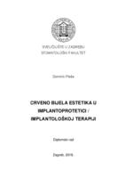 prikaz prve stranice dokumenta Crveno-bijela estetika u implantoprotetici/implantološkoj terapjij