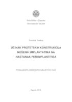 prikaz prve stranice dokumenta Učinak protetskih konstrukcija nošenih implantatima na nastanak periimplantitisa