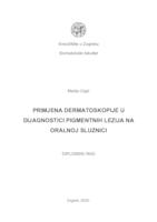 prikaz prve stranice dokumenta Primjena dermatoskopije u dijagnostici pigmentnih lezija na oralnoj sluznici