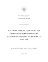 prikaz prve stranice dokumenta Postupak prekrivanja spontane ekspozicije pokrovnog vijka vezivnim transplantatom - prikaz slučaja